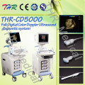 4D-Farbdoppler-Ultraschallscanner (THR-CD5000)